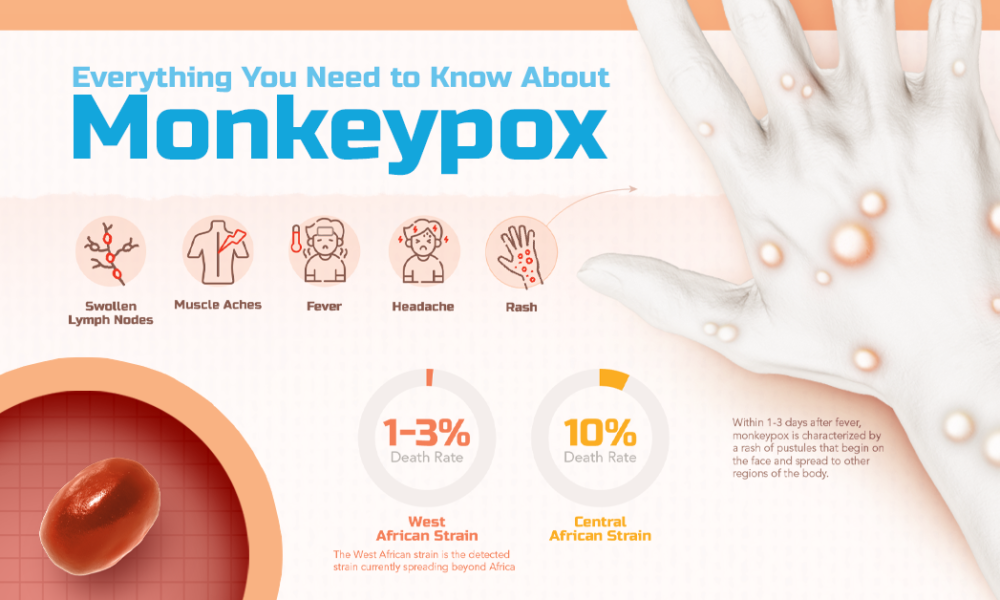 Monkeypox Outbreak Information - Valley-Wide Health